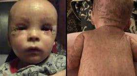 ce bébé souffre de problèmes de peau, ses parents utilisent un mère miracle
