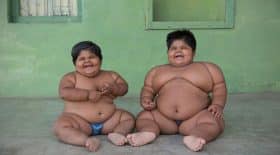 soeurs obèses chirurgie bariatrique