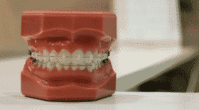 dent