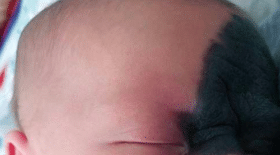 bébé, tache, visage, parents