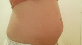 déni de grossesse, Alexandra, maman, bébé, grossesse, enceinte, morte, septicémie