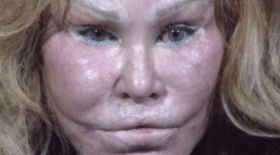 femme chat, Jocelyn Wildenstein, argent, dettes, chirurgie