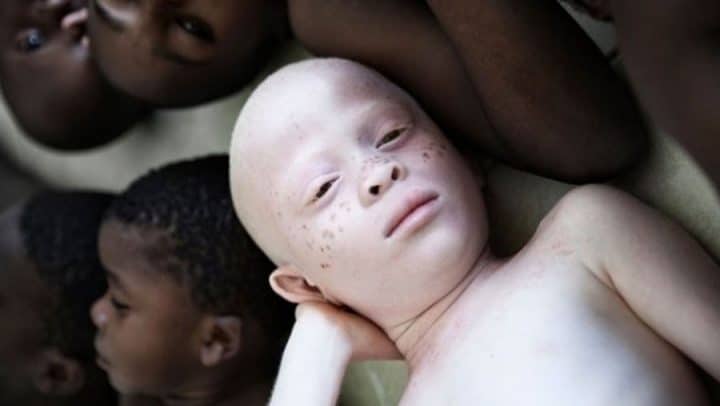 crime rituel petite fille albinos décapitée