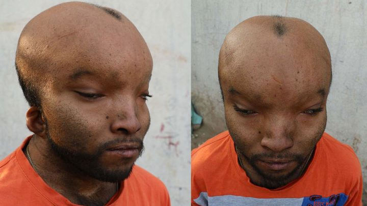 homme alien visage difforme crânce allongé