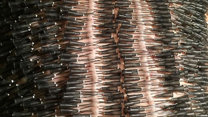 aiguilles jeu sexuel bdsm acuponcture