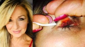 paupière irritée mascara démaquillage