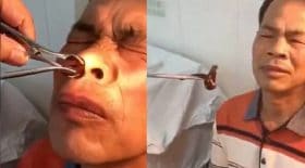 sangsue nez narine