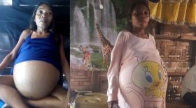 femme enceinte tumeurs utérus