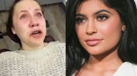 dents de sagesse effet anesthésiant kylie jenner