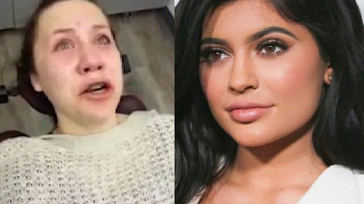 dents de sagesse effet anesthésiant kylie jenner