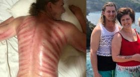 massage sang bali gua sha