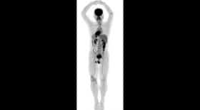 scanner 3D