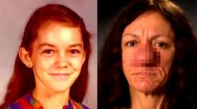 nez énorme rhinophyma maladie nez grossit
