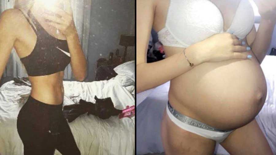 Enceinte De 9 Mois Son Ventre Etait Plat Son Ventre Grossit D Un Coup D Un Simple Geste De La Gyneco