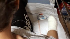 gilets-jaunes-amputer-main-grenade-explose