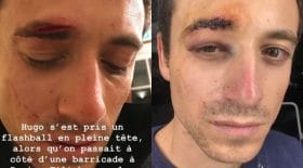 hugo-clement-tir-falsh-ball-plein-visage-gilets-jaunes-manifestation-bléssé