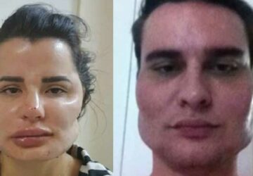 visage difforme chirurgien