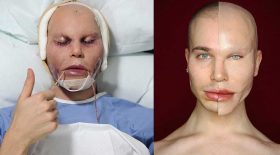 alexis stone fausse chirurgie