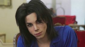 le sosie de michael jackson chirurgie esthétique