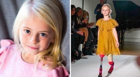 mannequin enfant doublement amputée défile