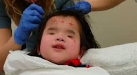 fillette née sans yeux chante hôpital