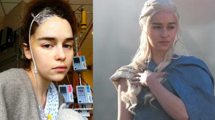 emilia clarke rupture d'anévrisme photos