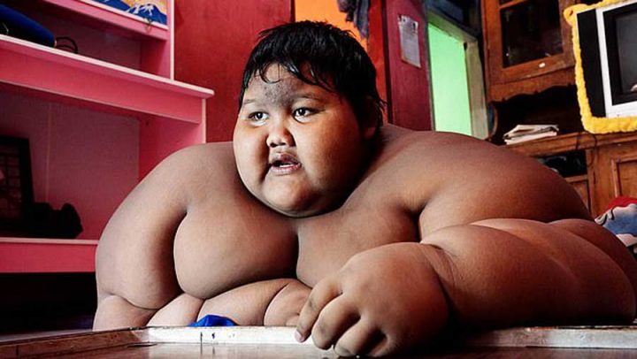 enfant le plus gros au monde a perdu du poids
