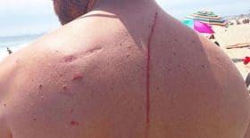attaqué par un requin, il découvre être atteint d'un cancer