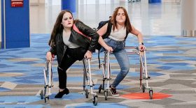 sœurs siamoises séparées à 4 ans