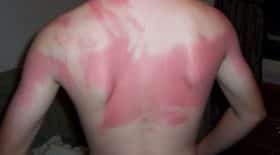 bronzage 22