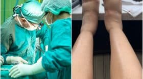 cardi b chirurgie esthétique