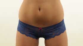 femme epilation jan serre