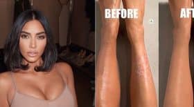 kim-kardashian-son-astuce-de-pro-pour-camoufler-son-psoriasis