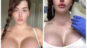 chirurgie