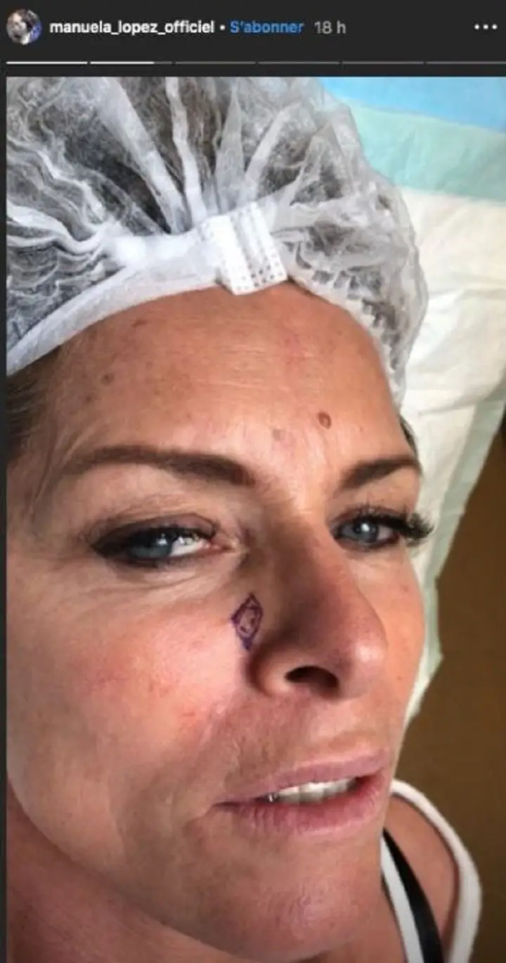 helene-et-les-garcons-manuela-lopez-avoue-etre-atteinte-dun-cancer-poste-des-photos-choquantes-sur-instagram