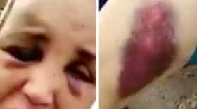 violences conjugales
