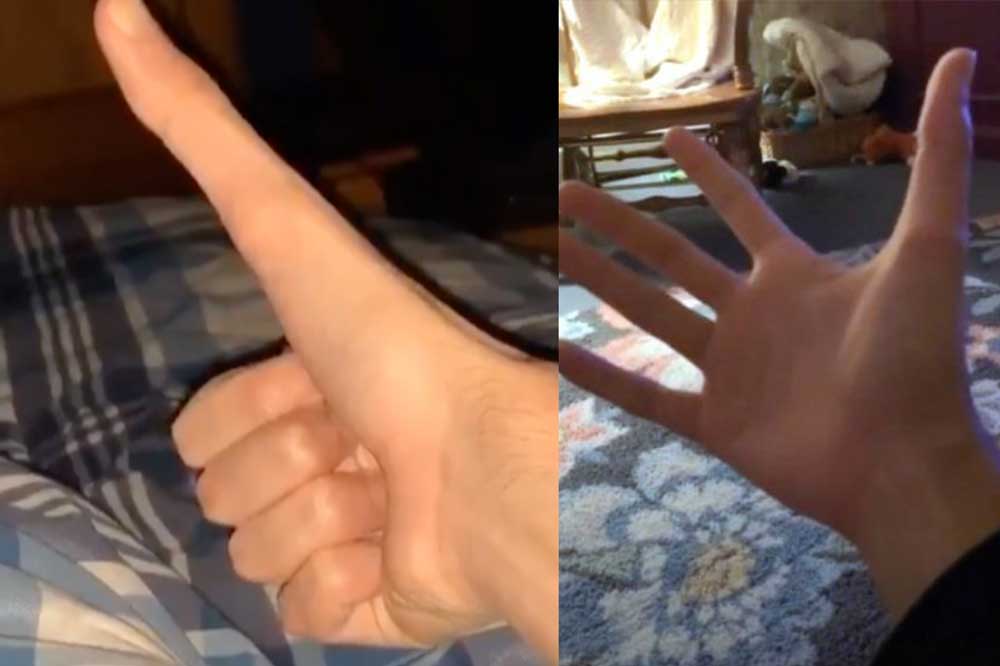 Le pouce de 13 cm de cet étudiant fait halluciner les internautes