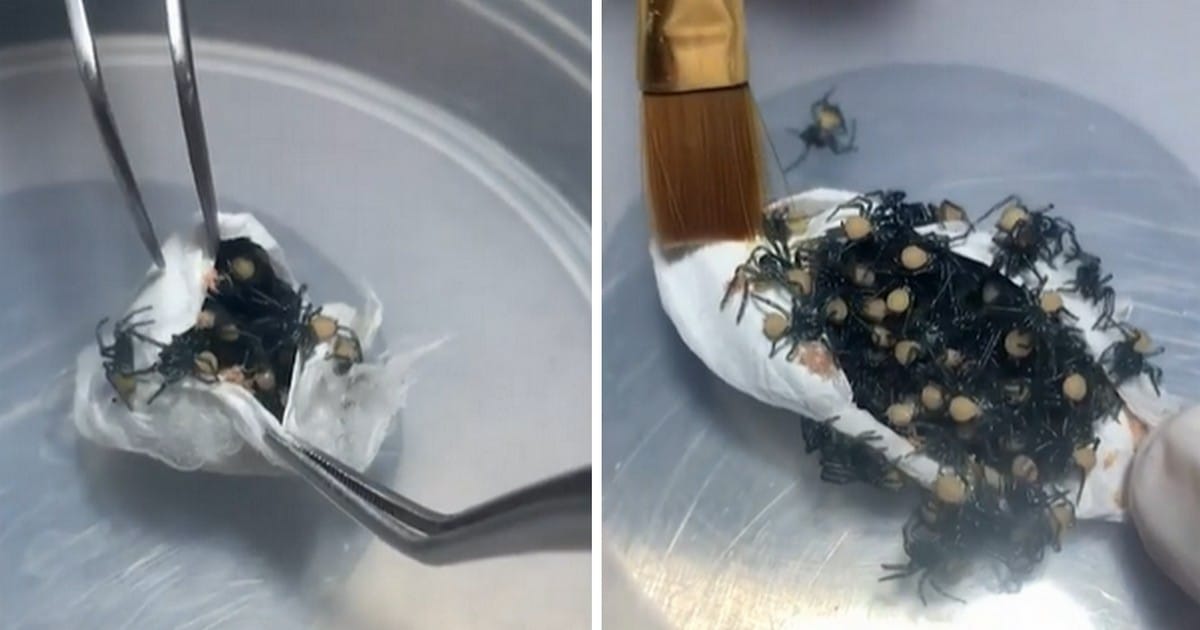 Il ouvre un œuf d'araignée et