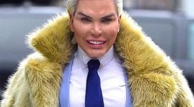 Le nez de Rodrigo Alves commence à se désagréger