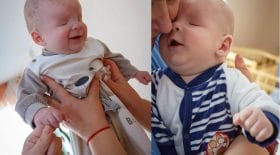 bébé né sans yeux