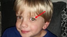 enfant cancer oeil fleche