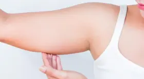 implant contraceptif