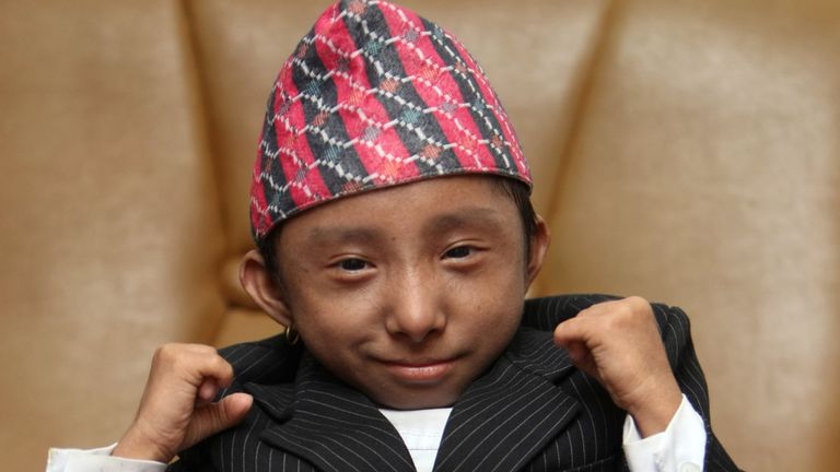 L'homme le plus petit du monde est décédé à 27 ans