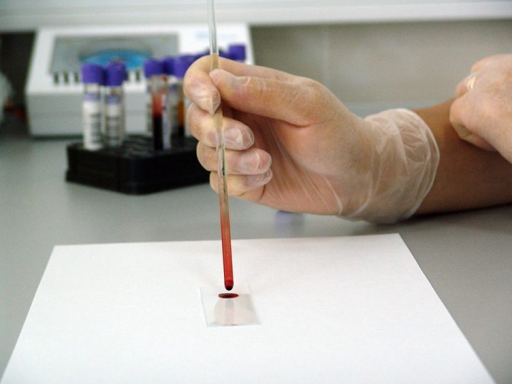 test échantillon urine