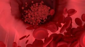 Coronavirus provoque des caillots