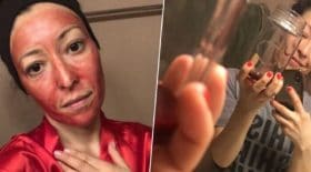 elle-utilise-le-sang-de-ses-regles-comme-soins-du-visage-et-ca-marche