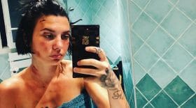 Une jeune femme se fait passer à tabac par trois individus dans la ville de Nîmes