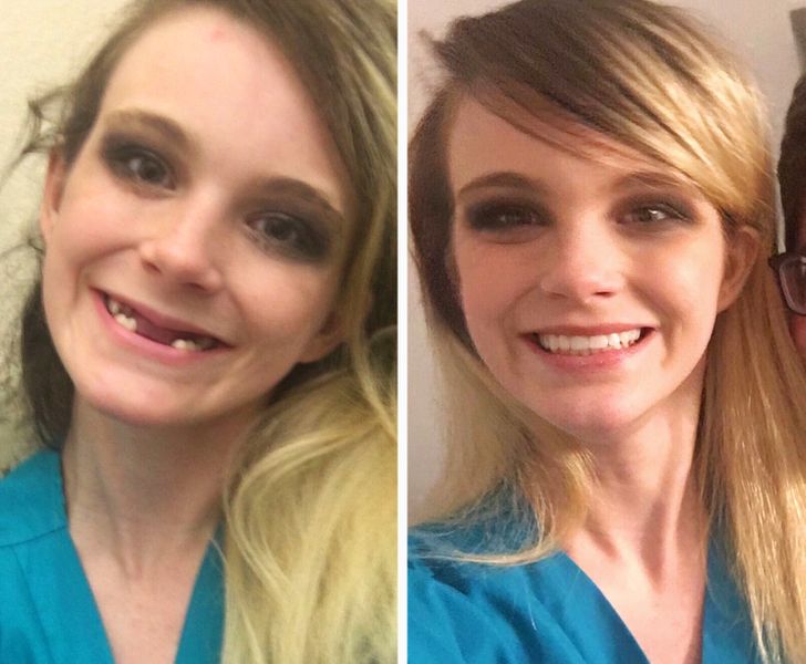 20 personnes dont la transformation physique est totalement bluffante ...