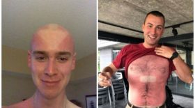 Elles auraient mieux fait de mettre de la crème solaire