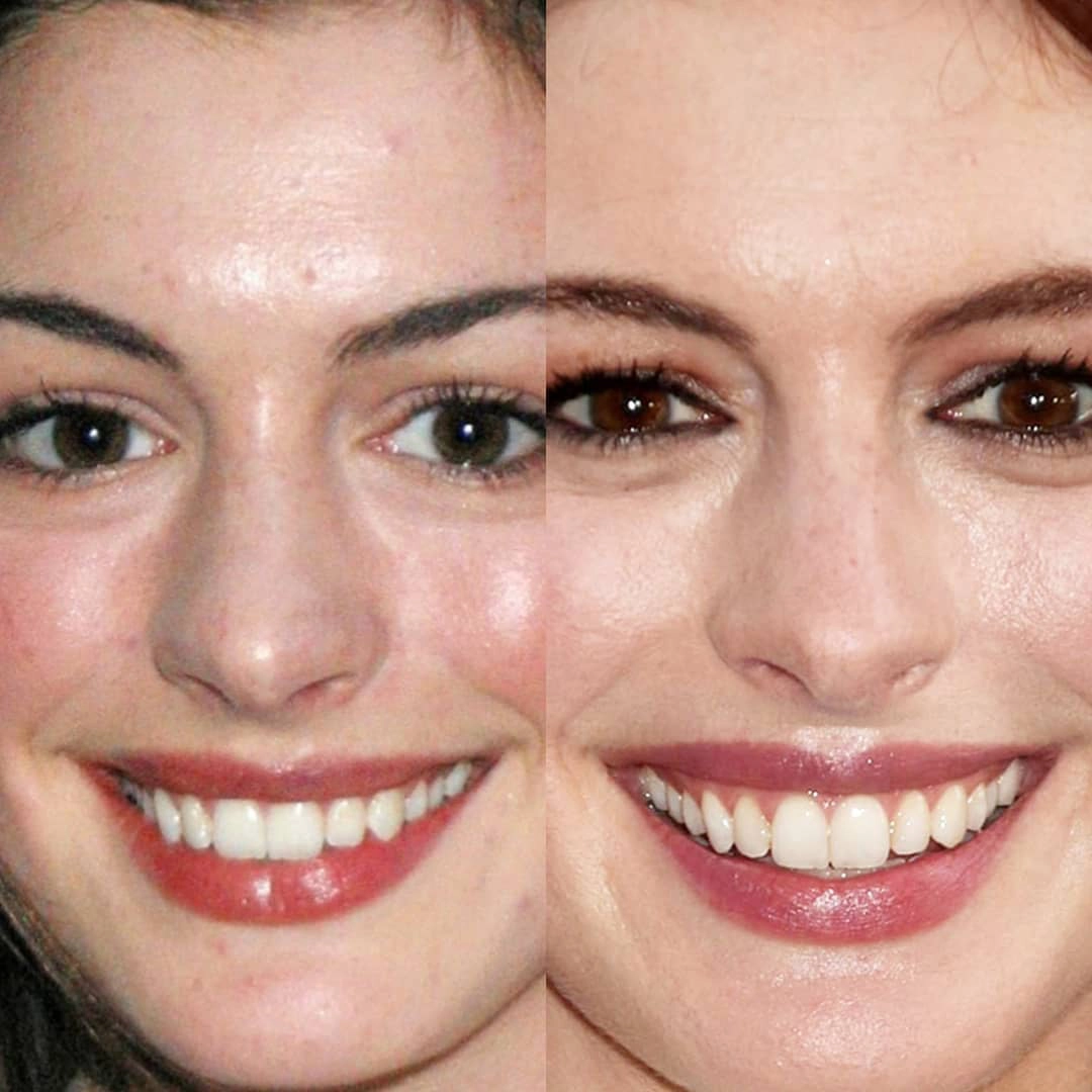 ANNE HATHAWAY